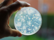 Fred: una bacteria modificada genéticamente para medir la contaminación en el agua